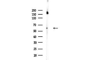 Western blot analysis of lysates from Rat brain, using Phospho-Tyrosine Hydroxylase (Ser31) Antibody at 1/1000 dilution.