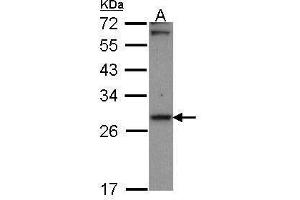 WB Image Sample (30 ug of whole cell lysate) A: A431 , 12% SDS PAGE Carbonyl reductase 1 antibody antibody diluted at 1:1000 (CBR1 anticorps  (C-Term))