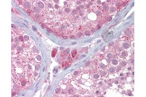 Anti-UBE2L3 antibody IHC of human testis.