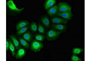 Immunofluorescent analysis of A549 cells using ABIN7167819 at dilution of 1:100 and Alexa Fluor 488-congugated AffiniPure Goat Anti-Rabbit IgG(H+L) (RAI1 anticorps  (AA 617-823))