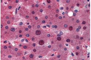 Human Liver: Formalin-Fixed, Paraffin-Embedded (FFPE)