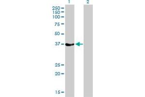 Western Blot analysis of RAD51 expression in transfected 293T cell line by RAD51 monoclonal antibody (M01), clone 2E5-E5.