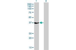 Western Blot analysis of RAD51 expression in transfected 293T cell line by RAD51 monoclonal antibody (M01), clone 2E5-E5. (RAD51 anticorps  (AA 1-242))