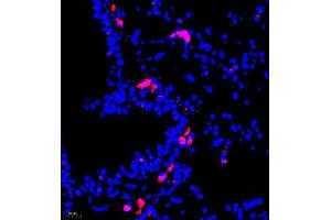 Immunofluorescence of paraffin embedded mouse lung using MHC-II (ABIN7074245) at dilution of 1:500 (400x lens)