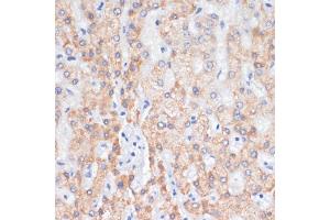 Immunohistochemistry of paraffin-embedded human liver using AREG antibody (ABIN6127431, ABIN6137065, ABIN6137066 and ABIN6216408) at dilution of 1:100 (40x lens). (Amphiregulin anticorps  (AA 20-252))