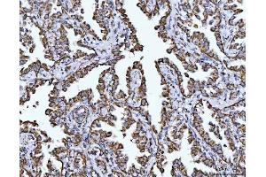 IHC analysis of COX5B using anti-COX5B antibody (ABIN7598975).