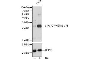 Western blot analysis of extracts of HeLa cells, using Phospho-HSP27/HSPB1-S78 pAb (ABIN3019892, ABIN3019893, ABIN3019894 and ABIN1681665) at 1:1000 dilution or HSP27/HSPB1 antibody (ABIN7267568). (HSP27 anticorps  (pSer78))