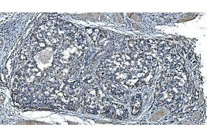 IHC analysis of TIMM8A/DDP using anti-TIMM8A/DDP antibody (ABIN7600039). (TIMM8A/DDP anticorps  (AA 14-97))