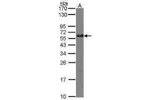WB Image Sample(30 μg of whole cell lysate) A: Raji 12% SDS PAGE antibody diluted at 1:500 (IFT74 anticorps  (C-Term))