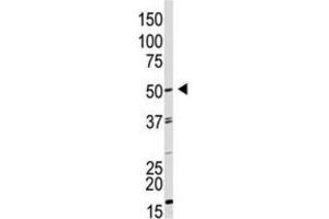 Western Blotting (WB) image for anti-Growth Differentiation Factor 9 (GDF9) antibody (ABIN3001444) (GDF9 anticorps)