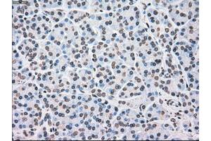 Image no. 3 for anti-Checkpoint Kinase 2 (CHEK2) antibody (ABIN1497498) (CHEK2 anticorps)