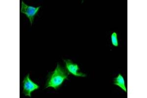 Immunofluorescence staining of SY5Y Cells with ABIN7127867 at 1:50, counter-stained with DAPI.