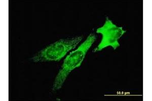 Immunofluorescence (IF) image for anti-Tumor Susceptibility Gene 101 (TSG101) antibody (ABIN781822)