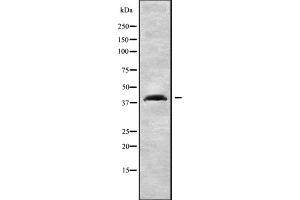 Western blot analysis of CCR3 using 293 whole cell lysates