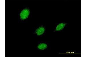 Immunofluorescence of monoclonal antibody to LHX5 on HeLa cell.