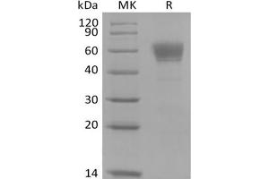 Western Blotting (WB) image for Interleukin 3 Receptor, alpha (IL3RA) protein (Fc Tag) (ABIN7321046)