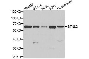 Western blot analysis of extracts of various cell lines, using BTNL2 antibody. (BTNL2 anticorps  (AA 246-455))