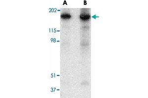 Western blot analysis of RTN4 in mouse brain tissue lysate with RTN4 polyclonal antibody  at (A) 0. (Reticulon 4 anticorps  (N-Term))