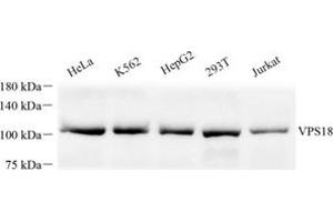 Western blot analysis of VPS18 (ABIN7076177) at dilution of 1: 500 (VPS18 anticorps)
