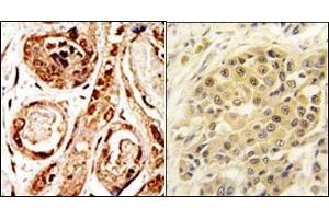 Image no. 1 for anti-SUMO/sentrin Specific Peptidase 3 (SENP3) (N-Term) antibody (ABIN356754) (SENP3 anticorps  (N-Term))