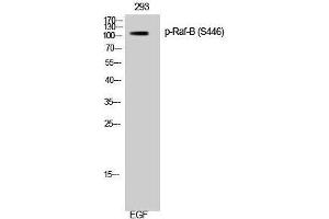 Western Blotting (WB) image for anti-B-Raf proto-oncogene, serine/threonine kinase (BRAF) (pSer446) antibody (ABIN3180451) (BRAF anticorps  (pSer446))