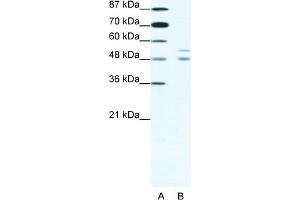 WB Suggested Anti-MITF Antibody Titration:  1. (MITF anticorps  (N-Term))