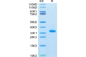 SARS-CoV-2 3CLpro (Q189K) on Tris-Bis PAGE under reduced condition. (SARS-Coronavirus Nonstructural Protein 8 (SARS-CoV NSP8) (Q189K) Protéine)