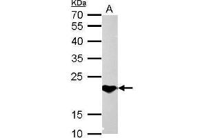 WB Image SOCS1 antibody detects SOCS1 protein by Western blot analysis.