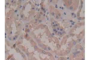 anti-rho-Associated, Coiled-Coil Containing Protein Kinase 2 (ROCK2) (AA 904-1140) antibody