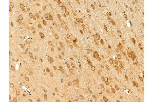 ABIN7094850 and ABIN7098901 at 1/100 staining Rat brain tissue by IHC-P. (CCT2 anticorps  (C-Term))