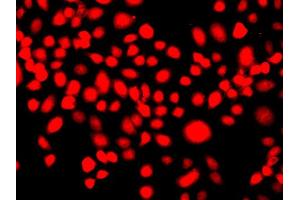 Immunofluorescence analysis of A549 cell using IFRD1 antibody.