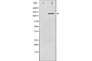 Western blot analysis of c-Abl phosphorylation expression in Insulin treated K562 whole cell lysates,The lane on the left is treated with the antigen-specific peptide.