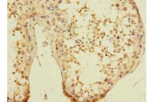 Immunohistochemistry of paraffin-embedded human testis tissue using ABIN7174603 at dilution of 1:100 (UBXN8 anticorps  (AA 55-270))