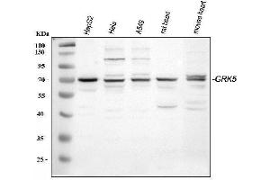 Western blot analysis of GRK5 using anti-GRK5 antibody (ABIN3042434). (GRK5 anticorps  (C-Term))