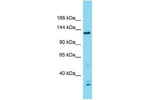 Western Blotting (WB) image for anti-DNA Repair Protein Complementing XP-G Cells (ERCC5) (N-Term) antibody (ABIN2785635) (ERCC5 anticorps  (N-Term))
