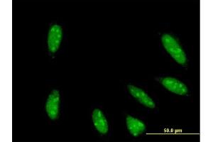 Immunofluorescence of monoclonal antibody to TAF6L on HeLa cell.