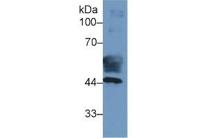anti-Keratin 19 (KRT19) (AA 127-322) antibody