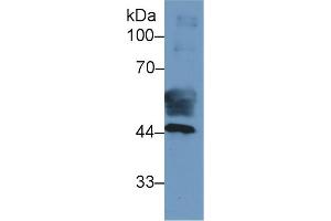 Detection of CK19 in Human Placenta lysate using Monoclonal Antibody to Cytokeratin 19 (CK19) (Cytokeratin 19 anticorps  (AA 127-322))