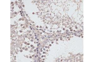 Immunohistochemistry of paraffin-embedded Rat testis using ATG14 Polyclonal Antibody at dilution of 1:100 (40x lens). (ATG14 anticorps)