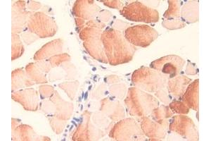 IHC-P analysis of Mouse Skeletal muscle Tissue, with DAB staining. (MID1 anticorps  (AA 1-212))