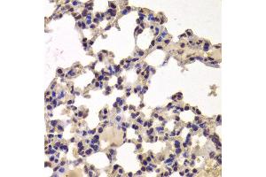 Immunohistochemistry of paraffin-embedded Mouse lung using HDAC7 antibody at dilution of 1:100 (x400 lens). (HDAC7 anticorps)