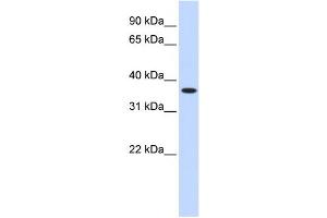 Western Blotting (WB) image for anti-Zinc Finger Protein 444 (ZNF444) antibody (ABIN2458190) (ZNF444 anticorps)