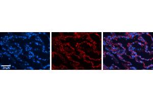 Rabbit Anti-RPL13 Antibody     Formalin Fixed Paraffin Embedded Tissue: Human Lung Tissue  Observed Staining: Cytoplasmic in alveolar mostly type I cells  Primary Antibody Concentration: 1:100  Other Working Concentrations: 1/600  Secondary Antibody: Donkey anti-Rabbit-Cy3  Secondary Antibody Concentration: 1:200  Magnification: 20X  Exposure Time: 0.