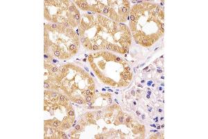Antibody staining APIP in human kidney tissue sections by Immunohistochemistry (IHC-P - paraformaldehyde-fixed, paraffin-embedded sections). (APIP anticorps  (AA 111-142))