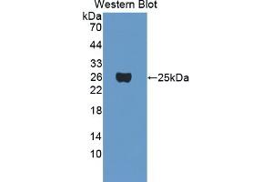 Detection of Recombinant CRYgF, Mouse using Polyclonal Antibody to Crystallin Gamma F (CRYgF) (CRYGF anticorps  (AA 1-173))