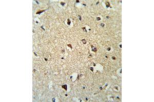 Immunohistochemistry (IHC) image for anti-rho GDP Dissociation Inhibitor (GDI) alpha (ARHGDIA) antibody (ABIN3001701)