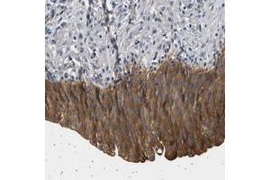 Immunohistochemical staining of human urinary bladder with PPAPDC2 polyclonal antibody  shows strong cytoplasmic positivity in urothelial cells at 1:50-1:200 dilution. (PPAPDC2 anticorps)