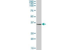 UMPS MaxPab polyclonal antibody. (UMPS anticorps  (AA 1-480))