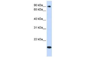 TSR1 antibody used at 1 ug/ml to detect target protein. (TSR1 anticorps)