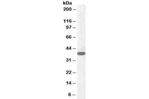 Western blot testing of human cerebellum lysate with Laforin antibody at 0. (EPM2A anticorps)